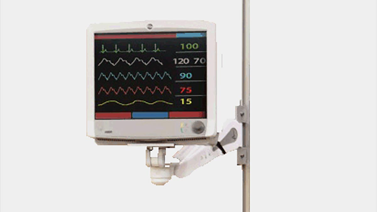 Patient Monitor & Display Mounts | Wall Mounts | Convergint IMS ...